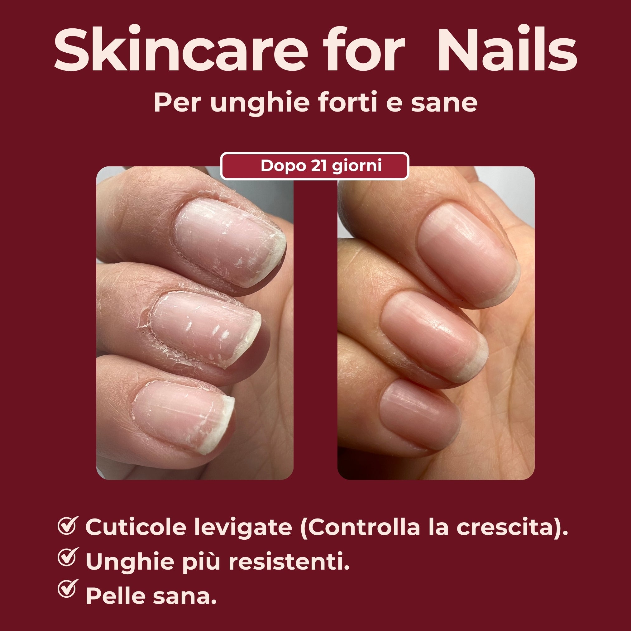 Mynailty® | Protocollo Rigenerante Skincare for Nails